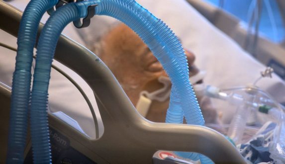 Governo federal assume compra de insumos para intubação de pacientes da covid-19 em SC